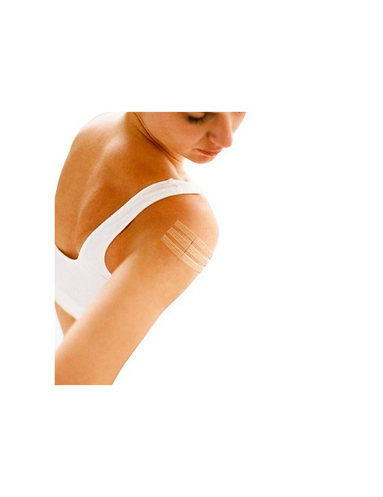 3M STERI STRIP BLANCO SUTURA CUTANEA ESTERIL 3 U 6 X 75 MM Y 5 U 3 X 75 MM